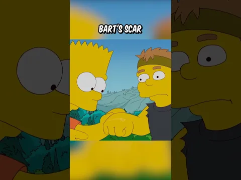 Bart's scar