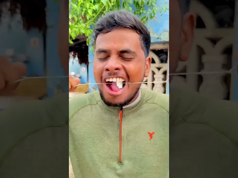చిన్ననాటి జ్ఞాపకాలు part 21 ❤️/UNBEATABLECULTUREVIDEO/UNBEATABLECULTURE COMEDY/CHINANAATIGNAPAKALU/