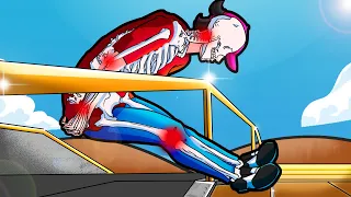 Me Rompí los Huesos a 79,252,848 km/h