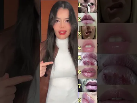 Como será tu boca después #shorts