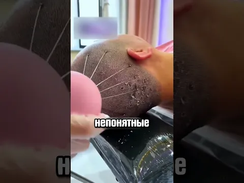 БЕГИТЕ в больницу если увидите это 😧