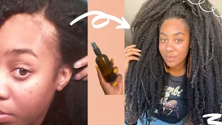 😲RESULTS IN 2 DAYS!!!! USE THIS!! HEALTHIEST SCALP, MASSIVE HAIR GROWTH & REGROWTH🤯