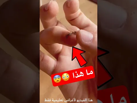 ماذا ؟؟؟؟