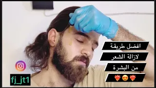 افضل طريقة لازالة الشعر من البشرة لا يفوتك الشرح✅✅