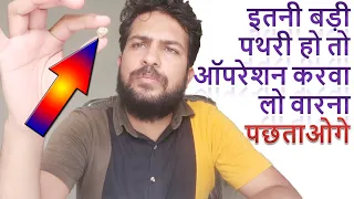 Pathri ka operation kab aur kitni badi pathari ho tab karna chahiye