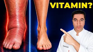 Foot Swelling: Why This Vitamin Is the #1 Natural Cure