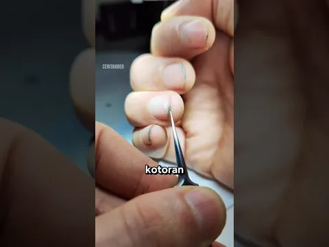 Kotoran kuku dilihat dari mikroskop😱