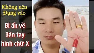 Bàn tay hình chữ x