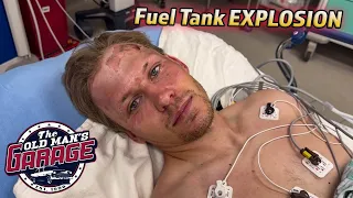 FUEL TANK EXPLOSION LEAVES BILLY HOSPITALIZED.