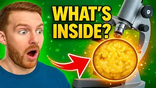 What 5 Common Foods Look Like Under a Microscope? 😱