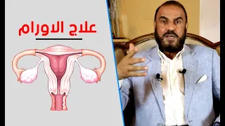سر خطير لعلاج اورام الرحم والعقم وانقطاع الدور الشهرية والاورام الليفية