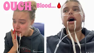 Getting All 4 of my wisdom teeth removed! *HILARIOUS*