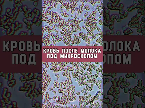 Молоко: что стало с кровью под микроскопом #эксперименты #наука #зож