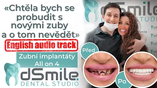 Zubní implantáty Jak probíhá implantace zubů?