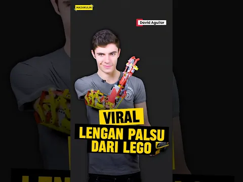 Kisah pria memiliki lengan lego 😱‼️