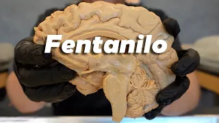 ¿Por qué el FENTANILO es INCREÍBLEMENTE peligroso?