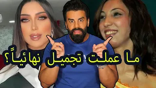دنيا بطمة تنكر خضوعها للتجميل "بحب الثقة" صح أنتي بدلتي راس "مبروك"