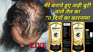 mashhadi herbal hair oil honestly review after 70 days result 100% work9557217026