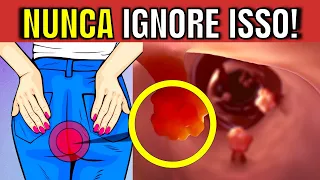 7 SINTOMAS de ALERTA de CÂNCER DE INTESTINO que você NUNCA PODE IGNORAR!