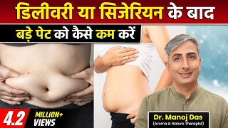 डिलीवरी या सिजेरियन के बाद बड़े पेट को कैसे कम करें I REDUCE BELLY FAT AFTER DELIVERY DR. MANOJ DAS