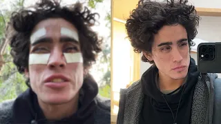 EYE SURGERY Full Week Vlog