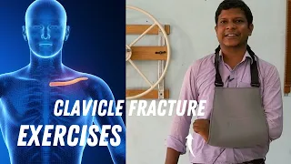 13 Top Clavicle Bone Fracture Recovery Exercises| Broken Collarbone