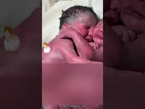 شوفو التوأم حديثي الولادة 😘 سبحان الله 💚