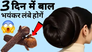 कसम से एक बार इसे लगाकर देखो बालों की लंबाई इतनी बढ़ेगी बस करवाते रहोगे,Cloves For Hair Growth