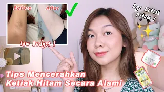 Ketiak Cerah & Mulus Perawatan Sendiri || My Armpit Routine