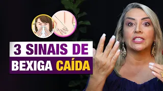 3 SINAIS QUE SUA BEXIGA ESTÁ CAINDO | SAÚDE DA MULHER