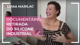 DOCUMENTARIO DA MINHA CIRURGIA COMN DR MARRA