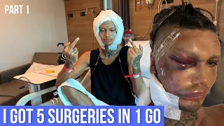 I GOT A FACELIFT IN MY 20’S | + 4 Other procedures | Recovery + Complications