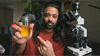 What Urine Looks Like Under The Microscope (Sperm found)