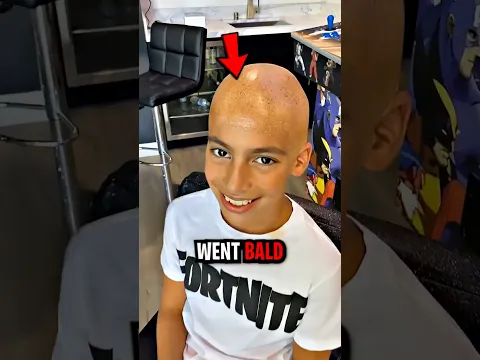 King Ferran Went Bald To Prank His Mom! 😲