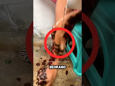 Wanita Ini Punya Serangga di Lengannya, dan Tak Ada yang Bisa Menghapusnya…😱