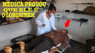 urgente-MÉDICA NAO ACREDITAVA ATÉ ELA VER Á VERDADE SOBRE O LOBISOMEM