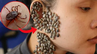 Most Dangerous Insects in the World In Hindi/Urdu | Most Dangerous Bugs in the World | Part 2