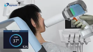 Eighteeth Portable X ray HyperLight
