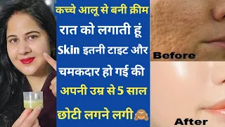 My 55 year Mom apply potato cream every night & has clean skin- glass skin & skin whitening cream
