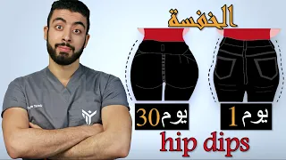 تخلصى من الخفسة نهائيا فى 30 يوم | هذا هو السبب الحقيقى لوجود الخفسة !