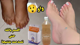 تهلاي في رجيلاتك  توريد وترطيب وتبييض وحتى لطراس سندالة غادي يحيد❤