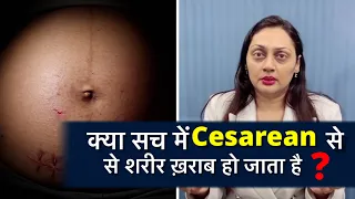 क्या सच में Cesarean से शरीर खराब हो जाता है ? || Dr.Poonam Maggo 