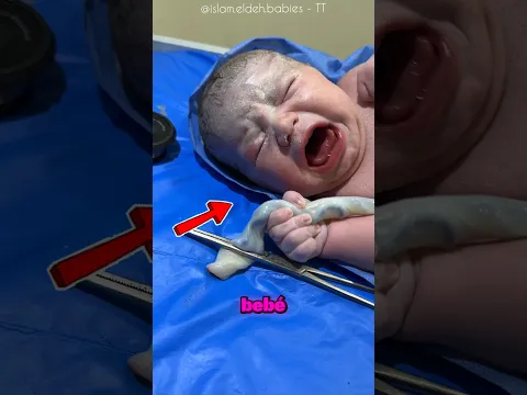 El bebé que no quiso soltar su primer vínculo ❤️ #shorts