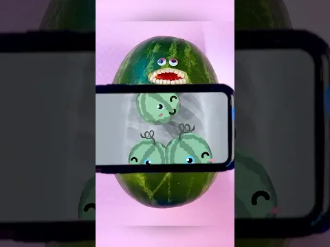 Why Did The End Make Me Cry? 😭🍉🤧💔 Triplet C-Section #foodsurgery #fruitsurgery #discountdentist