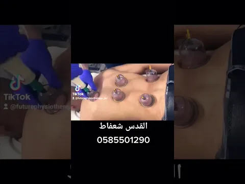 تع اعمل حجامة