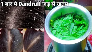 डैंड्रफ हटाने का सबसे आसान घरेलु तरीका | How to Treat Dandruff at Home | Dandruff Removel Remedy