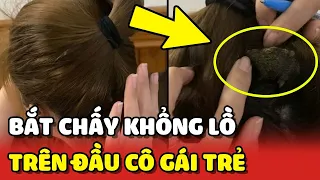 Cô gái bị ngứa đầu, ai dè bắt được con "CHẤY KHỔNG LỒ" và cái kết hú hồn 😮 | Yêu Lu