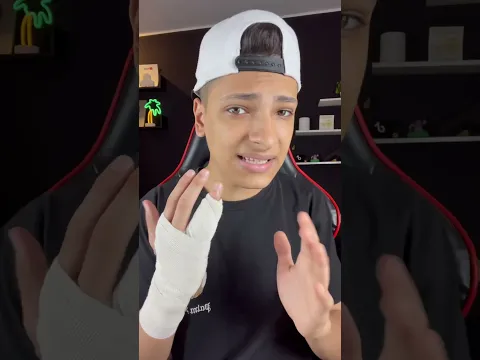 سبب الشكل الغريب ليد كريم بنزيما 😰