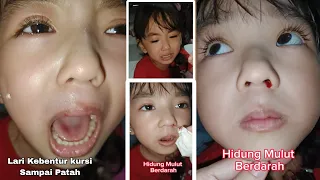 Drama Emma Jatuh Berdarah... Anak Nangis...