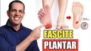 FASCITE PLANTAR Resolvida! - CHEGA DE DOR NO CALCANHAR